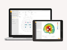 Top 10 EEG Data Analysis Tools for Effective Brain Research