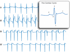 Heart beat monitoring – what can we learn?