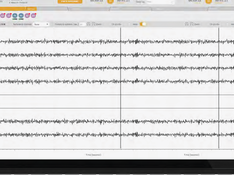 Monitoring effects of Transcranial Current Stimulation with EEG, fMRI, MEG, NIRS.