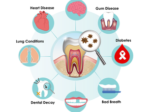 What Problems Could Poor Dental Health Cause