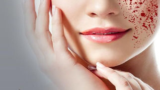 Revitalize and glowing skin? Let’s talk about Vampire Facial