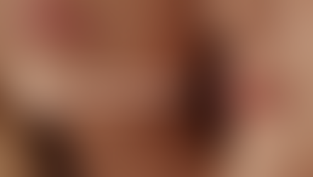 Bella Lightening Lips: A Non-Invasive Laser Lightening for your Lips