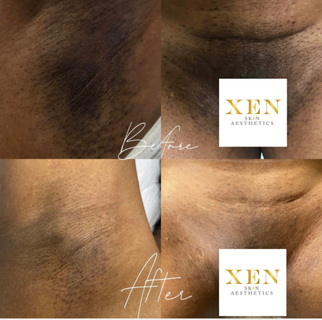 XEN SKIN AESTHETICS 1.png