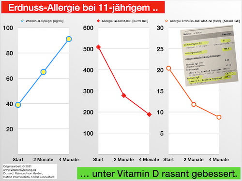 Miniatura: Grafik, die zeigt wie die Allergie-Reaktion abnimmt, wenn der Vitamin-D-Spiegel steigt.