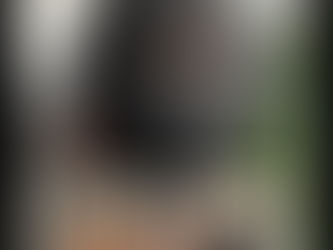 Advanced Hair Restoration Solutions for Natural and Lasting Results