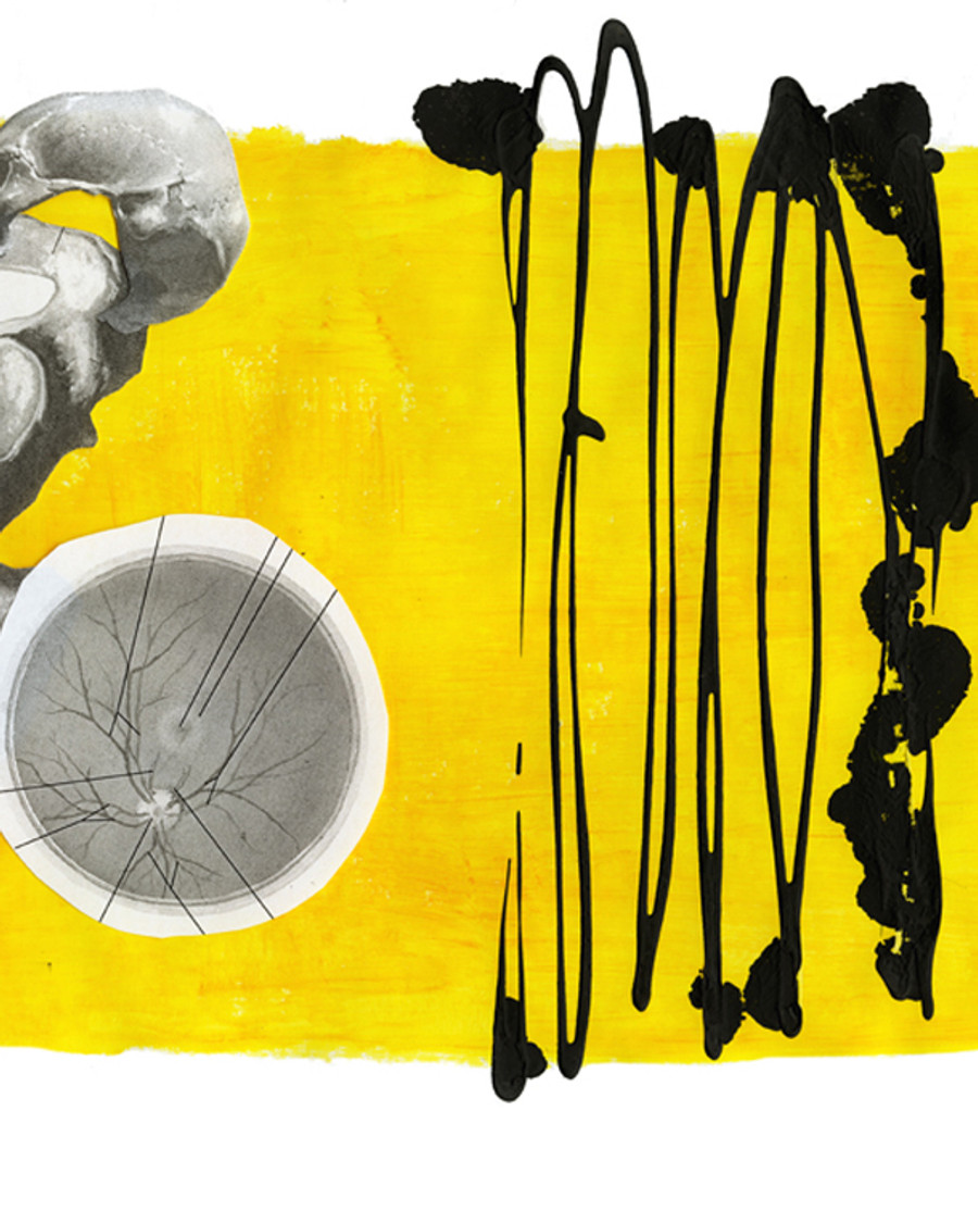 Anaesthetic — oil and pastel, 2024