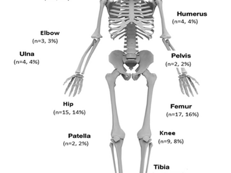 Antibiotics Unveiled: Tailoring Treatments for Bone & Joint Infections in Cape Town.