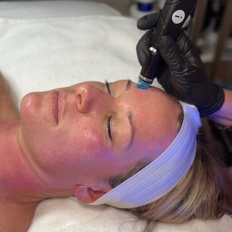 Your HydraFacial Treatment Guide