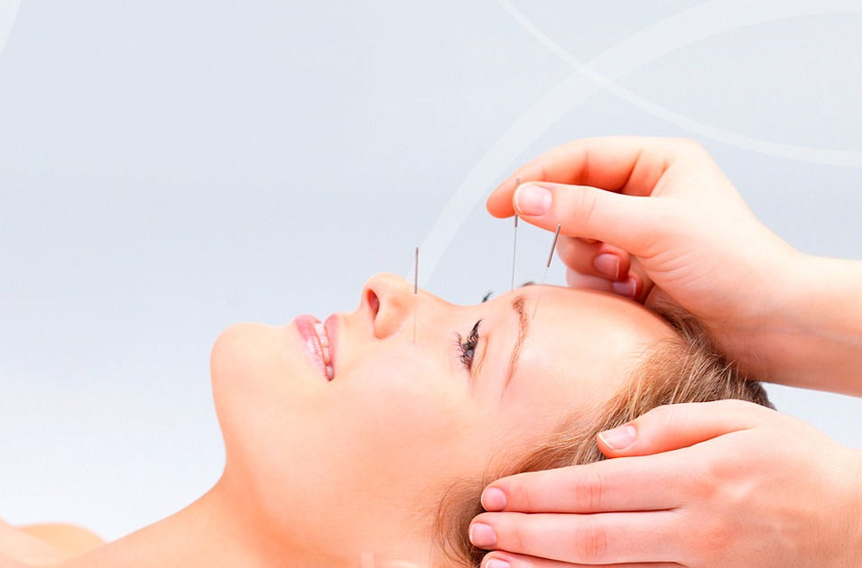 Acupuntura Facial
