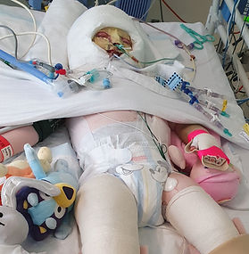 How to Protect your Child from Burns & Scalds