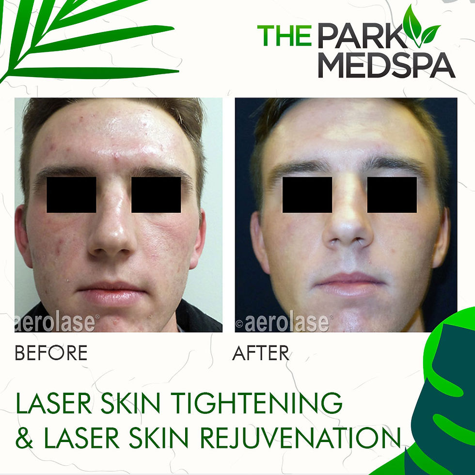 Skin Rejuvenation & Tightening at The Park Med Spa in Highland Park, NJ