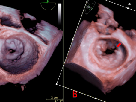 Respuesta al caso de la semana 