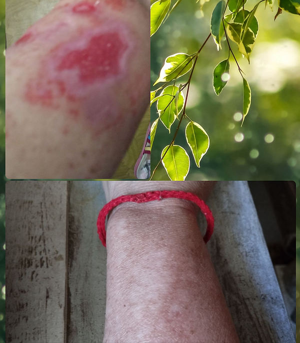 клещ до и после.png