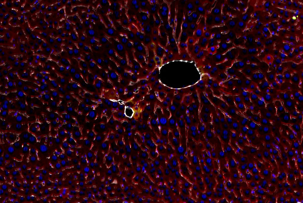 Disseminated Tumor Cells in Liver.tif.jp