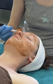 SS applying cocoa enzyme.png