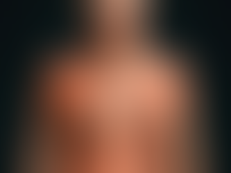 Revmatoid Polymyalgi