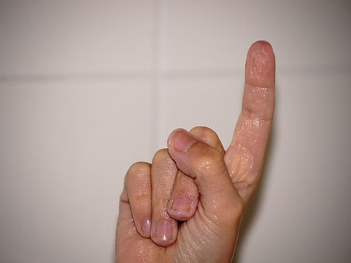 Capillary Refill Test (CRT)