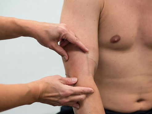 Elbow Plica Impingement Test