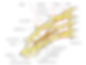 Brakialplexus