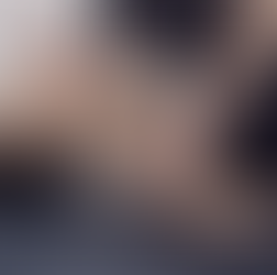 Adductor Squeeze Test