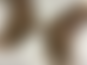 Revmatisk artritt i hånden