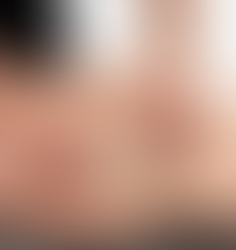 Anterior Drawer Test (Shoulder)