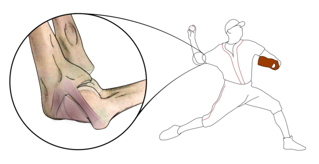 R.J. Molenaars CC https://commons.wikimedia.org/wiki/File:Anatomy_of_the_ulnar_collateral_ligament_in_the_pitcher%27s_elbow.png