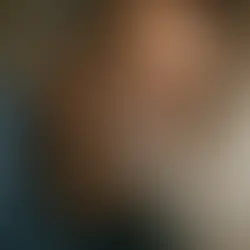 Søvn apné
