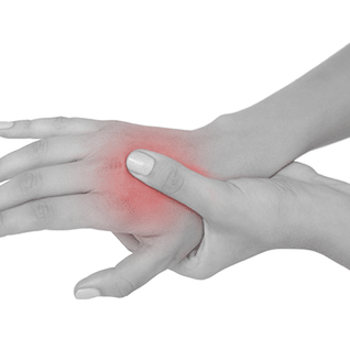 Midcarpal Instabilitet