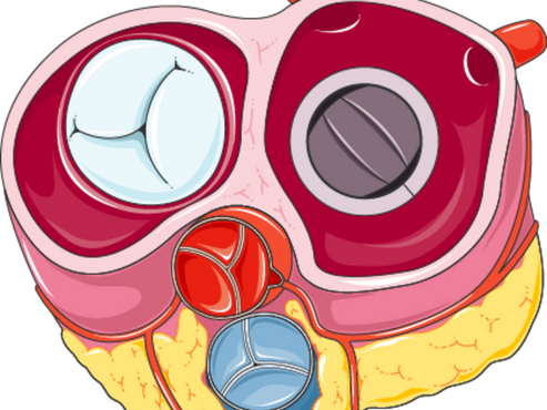 Feil i hjerteklaffene