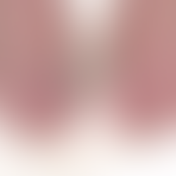 Crohn’s disease (CD)