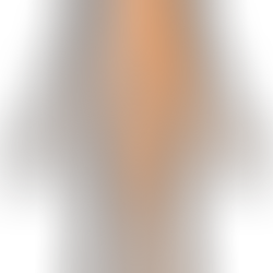 Hemiplegisk skuldersubluksasjon