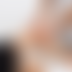 Patellar apprehension test for lateral patellar instability