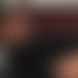 Utførelse av Cervical rotasjon lateral fleksjonstest