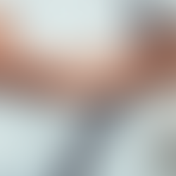 Idrettsskader i hånd og håndledd