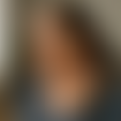 Cervicocephalic Syndrome (CCS)