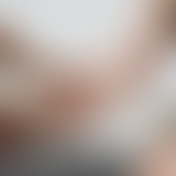 Varus stress test (Elbow)