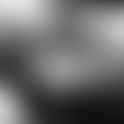 Diplopia (Double Vision)