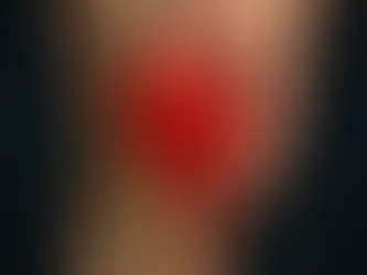 Compartment syndrom i leggen