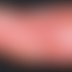 Scleroderma (Systemic Sclerosis)