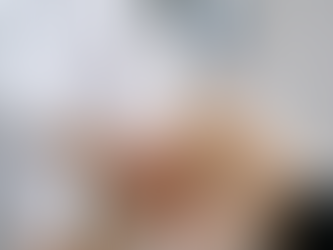 Anterior Drawer Test