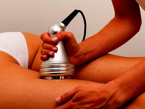 lipocavitation-estheclinic-singapore.jpeg