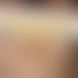 The Healing Power of Castor Oil Packs