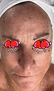 pic-client Aging-Pigment'n BEFORE