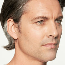 Collagen rejuvenation Colorado Springs