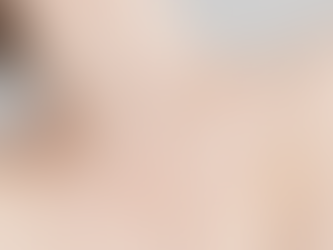 瘦肩針速成天鵝頸全攻略!虎背熊腰唔洗驚!詳解注射效果、副作用與維持秘訣!