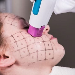 Side Blog 76 - thermage2.png