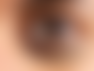 熊貓針黑眼圈救星!係咪可以輕鬆擺脫淚溝眼袋?效果原理、副作用與價錢指南