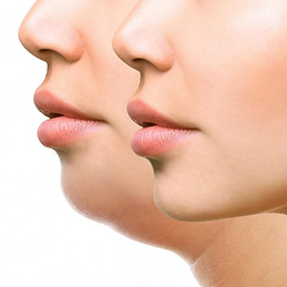 Side Blog 78 - skincare2.png