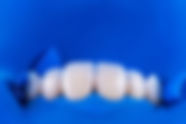 Faccette_Dentali.jpg